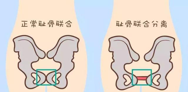 演员孙铱耻骨痛到无法走路，孕晚期的四大煎熬，怀过孕的深有体会  孙铱 第7张