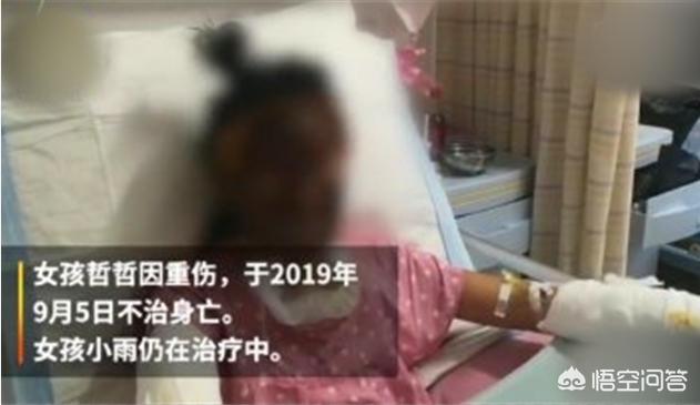 山东女孩模仿办公室小野弄爆米花，酒精爆炸女孩烧伤死亡，父亲欲起诉主播和平台你怎么看？  办公室小野 第3张